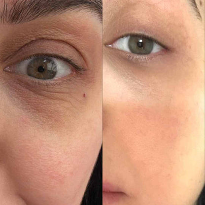 4-IN-1 EYE CREAM: Your Solution for Puffy Eye Bags, Wrinkles & Dark Circles