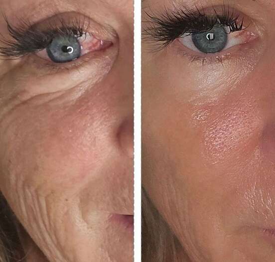 BOTOX COLLAGEN ANTI-WRINKLE FACIAL OIL: Deep Wrinkle Treatment