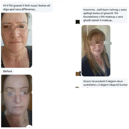 BOTOX COLLAGEN ANTI-WRINKLE FACIAL OIL: Deep Wrinkle Treatment