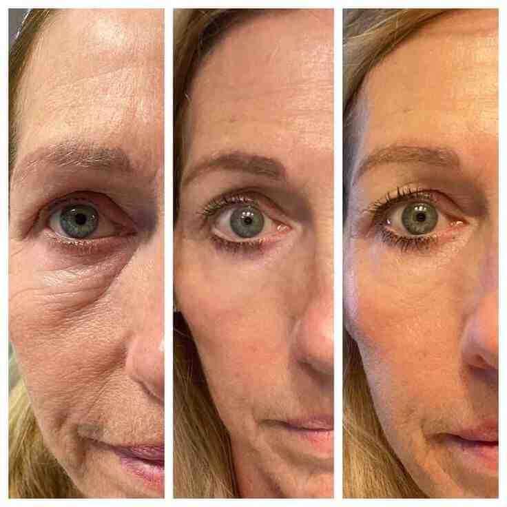 4-IN-1 EYE CREAM: Your Solution for Puffy Eye Bags, Wrinkles & Dark Circles